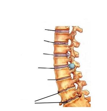Osteokonondrosaren garapen faseak